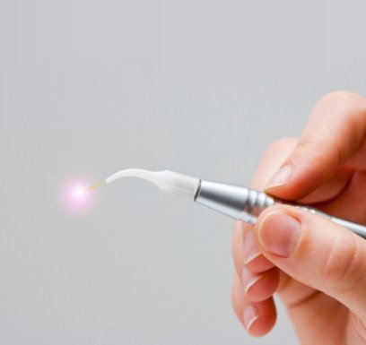 Soft tissue laser dentistry hand tool