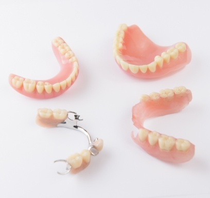 Four types of partials and full dentures